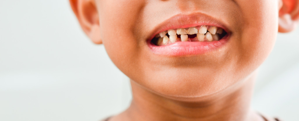 Child with dental caries